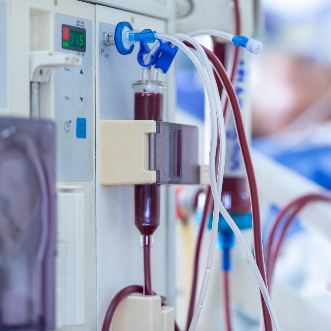 Hemodialysis