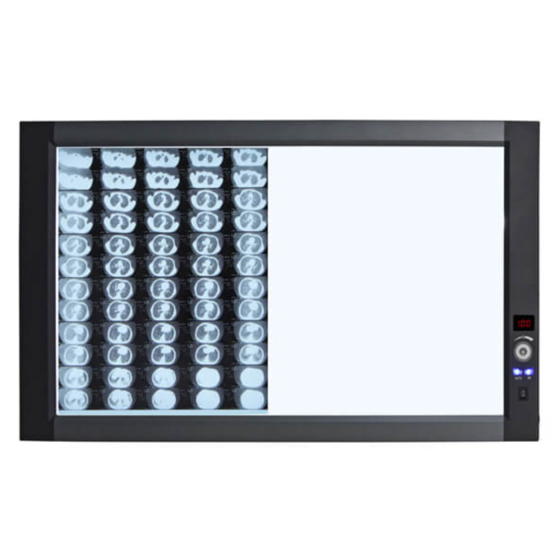 LED X Ray Film Viewer (Sidelight Mode)