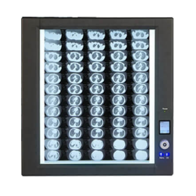Ultra Bright LED X Ray Film Viewer(Back Light Mode)