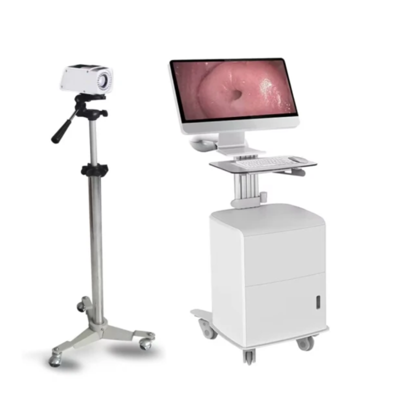 Digital Portable Gynecology Colposcope (1)
