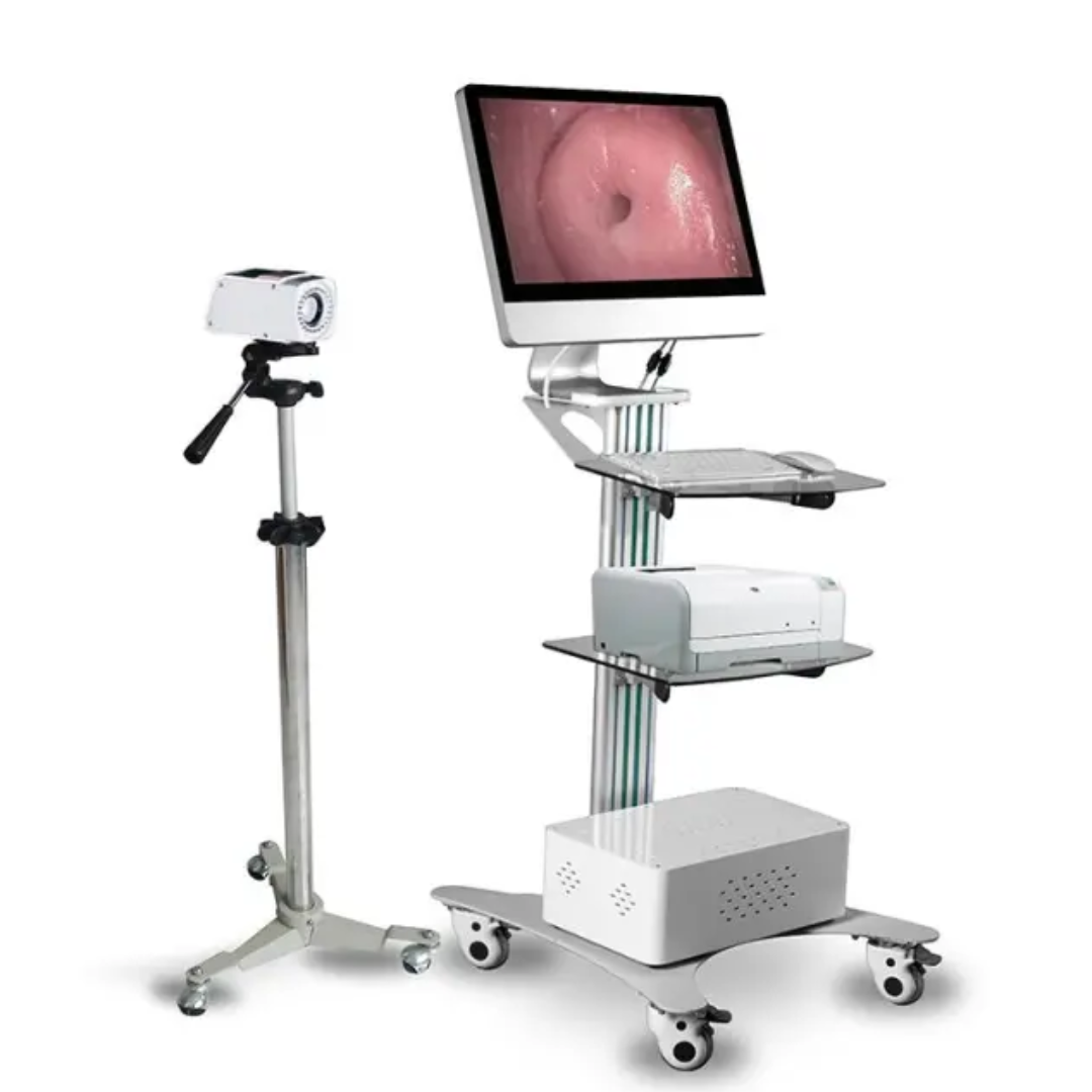 Digital Portable Trolley Gynecology Colposcope