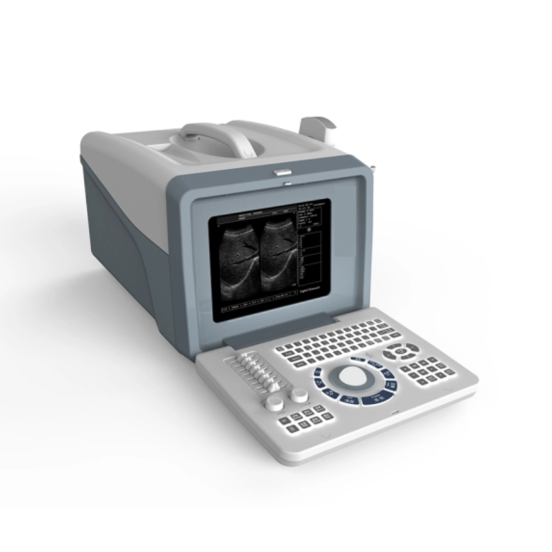 FTL UTS70 Portable BW Ultrasound Cheap LED Portable 2D Ultrasound Scanner price