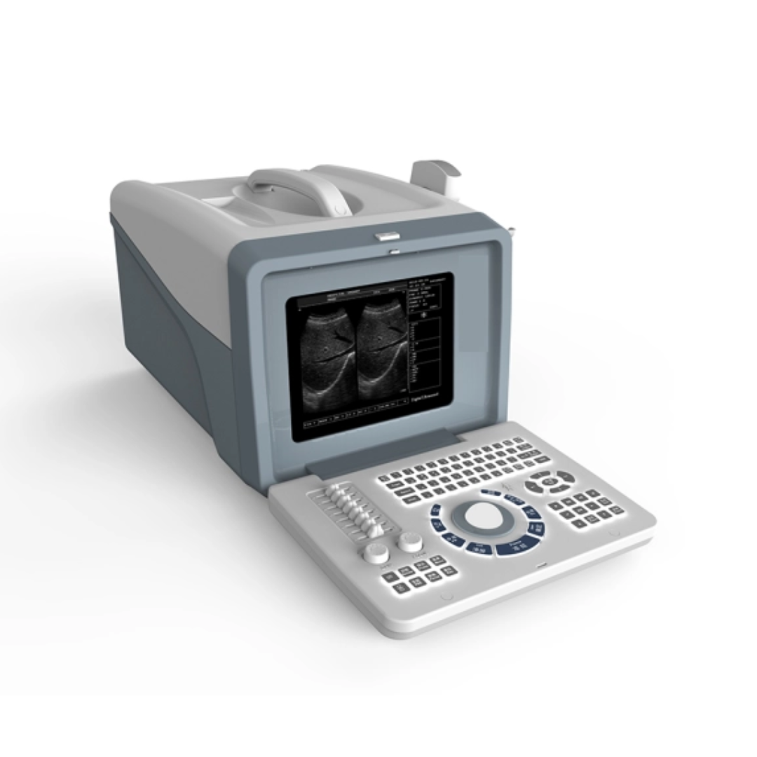 FTL UTS70 Portable BW Ultrasound Cheap LED Portable 2D Ultrasound Scanner price