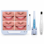 FTLDEN521 Intraoral Camera 1080x1080