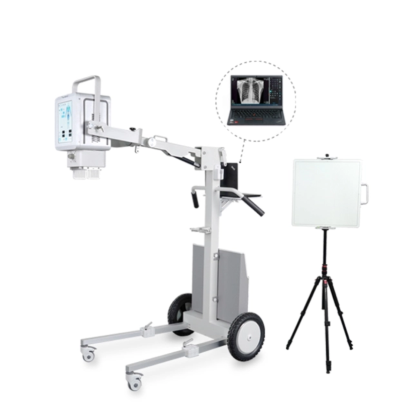 FTLF056 PD Digital Portable X Ray Machine with DR 5.6KW Medical Imaging Products