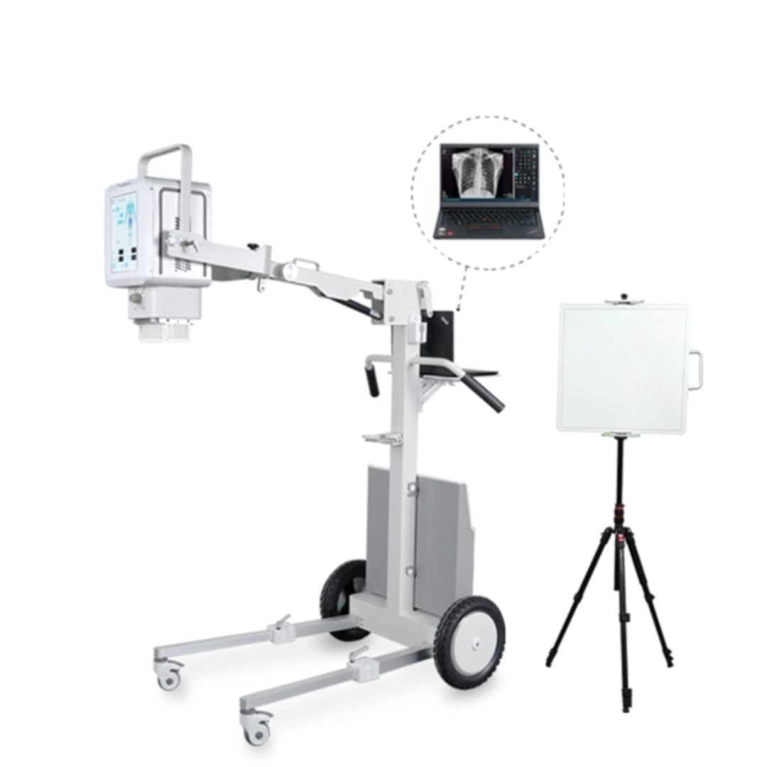 FTLF056 PD Digital Portable X Ray Machine with DR 5.6KW Medical Imaging Products
