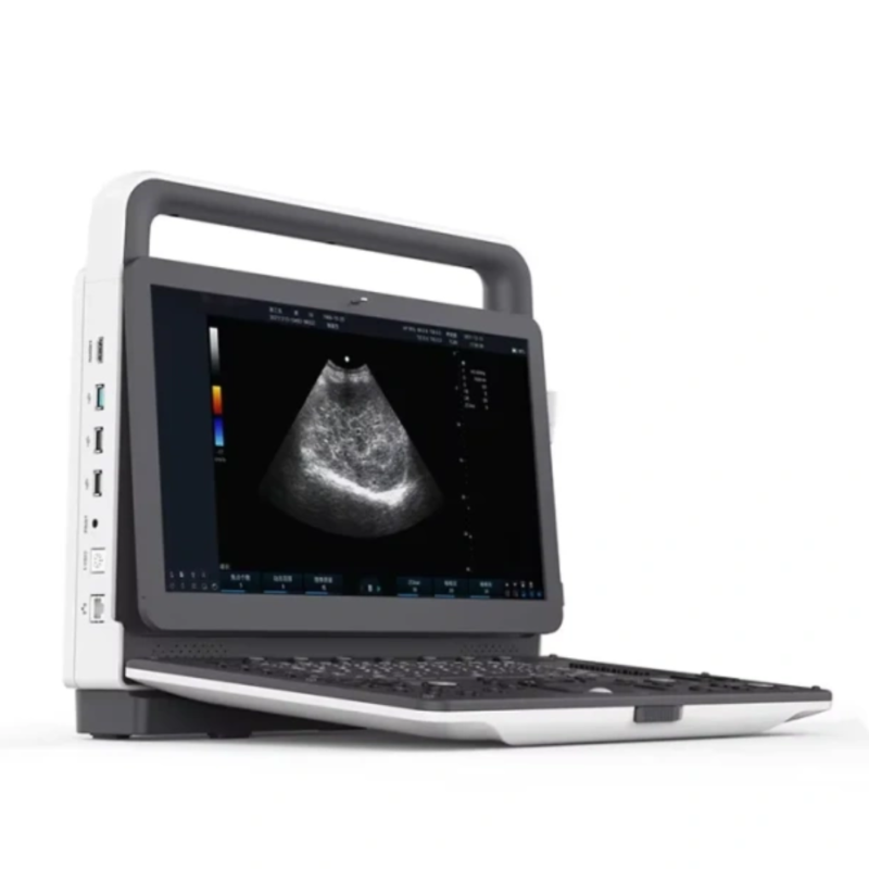 Fatali Promo Portable Digital Ultrasound Machine Human Ecografo