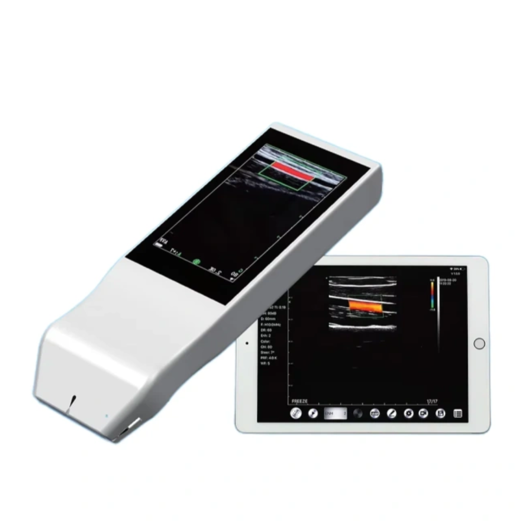 Hospital Portable Wireless Ultrasound Machine Easy Diagnosis Anywhere