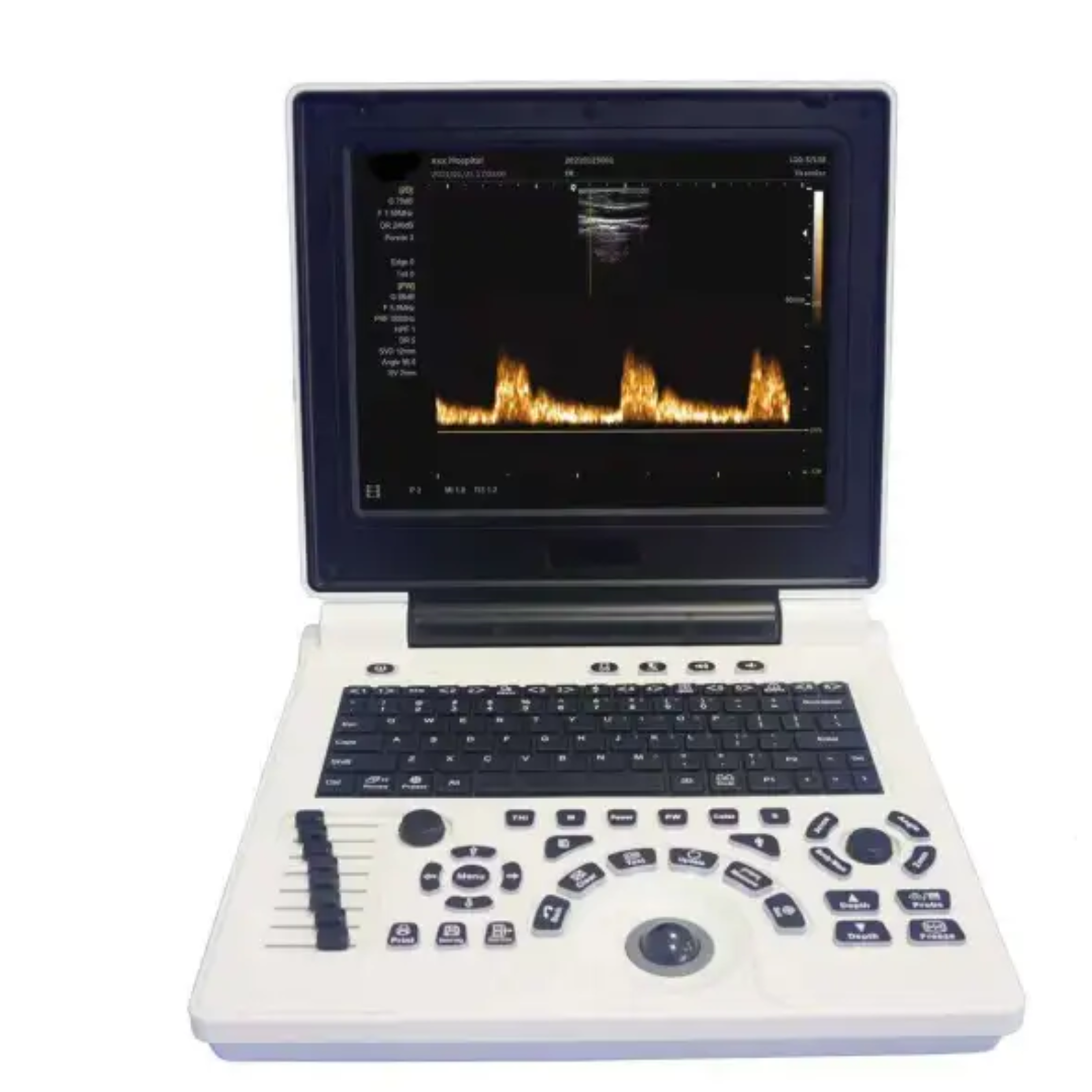 Laptop BW Ultrasound Machine FTL P20