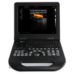 Laptop Ultrasound Machine FTL E30