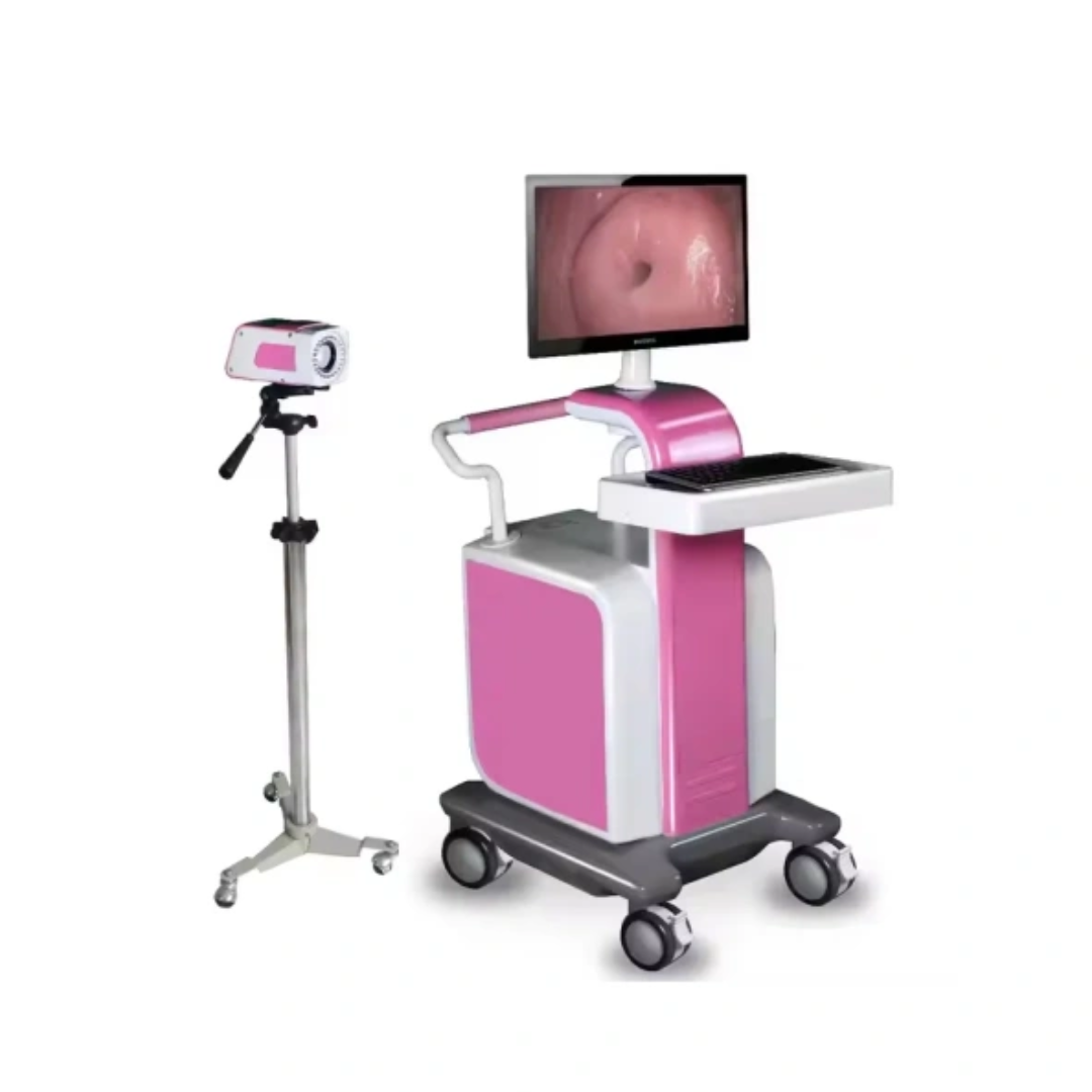 Medical HD Digital Video Colposcope Camera Gynecology Colposcope Portable Trolley type