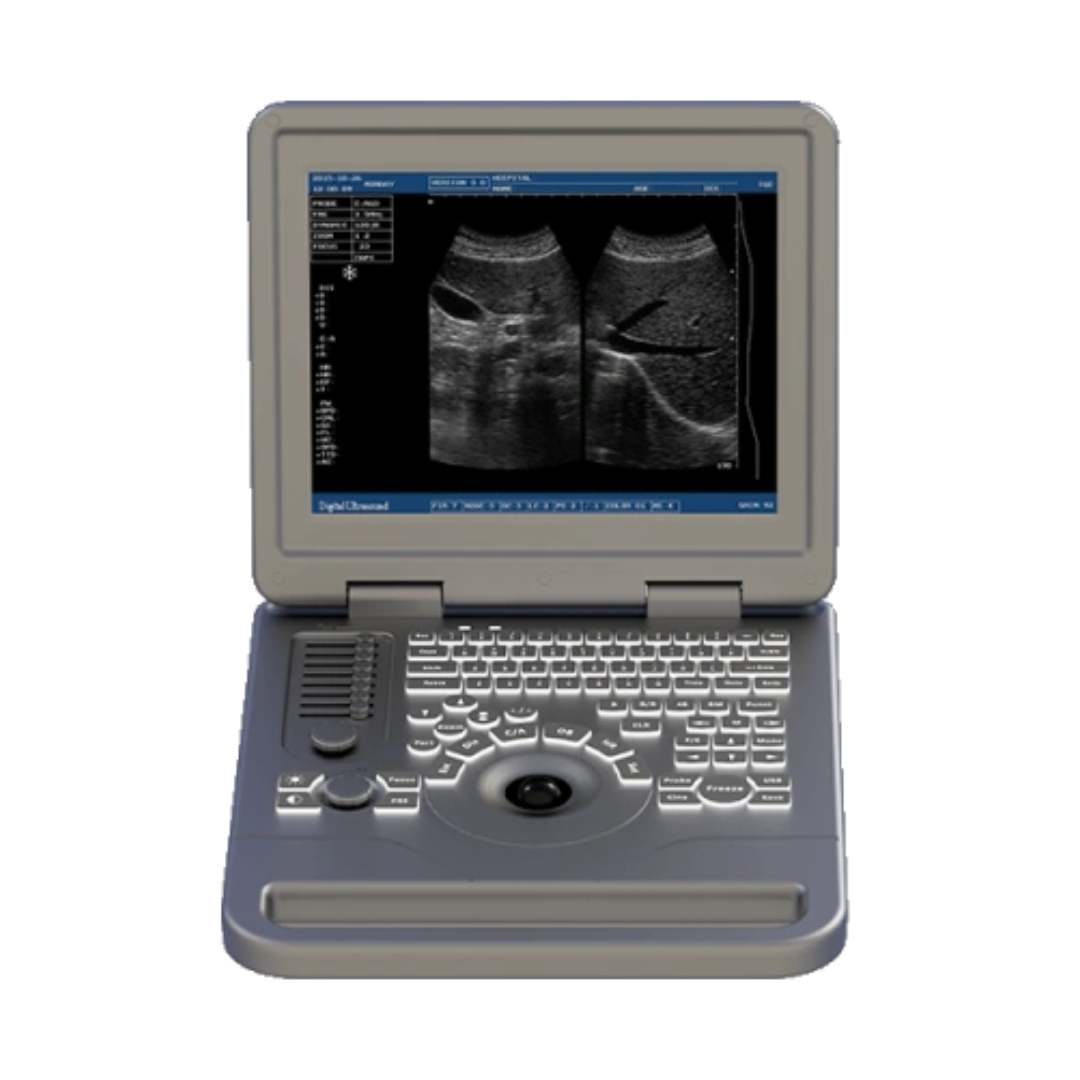 Notebook BW Ultrasound Machine FTL S70A