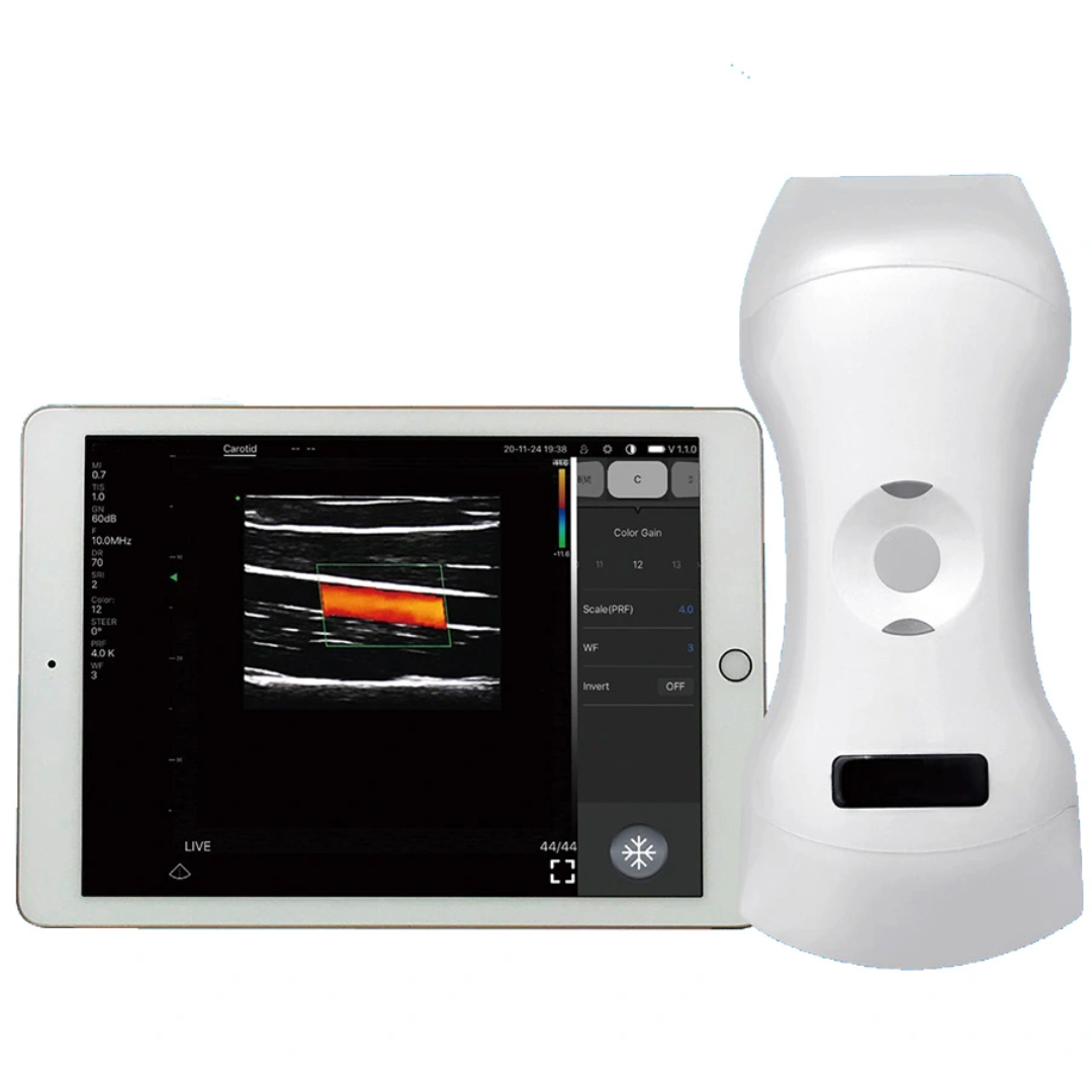 Pocket Ultrasound Machine Price Portable Wireless Ultrasound Double Probe with Wifi