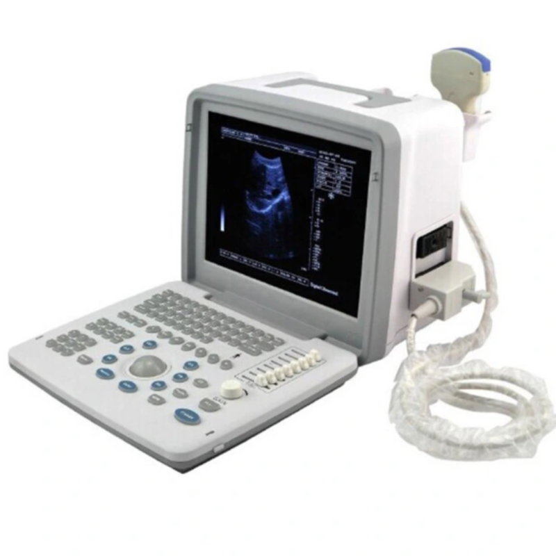 Portable 2D Ultrasound Diagnostic Urgent Care Ultrasound Machine