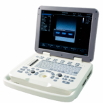 Portable Ultrasound Console