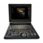 Portable Ultrasound Machine FTL E20