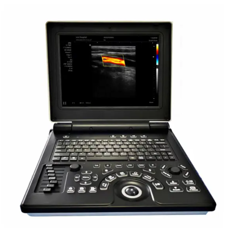 Portable Ultrasound Machine FTL E20