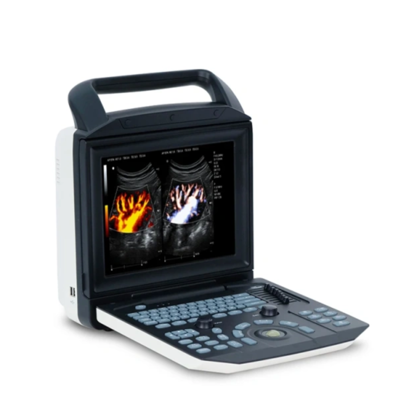 Promotion 3D 4D Portable Color Doppler Ultrasound Scanner ECHO Machine